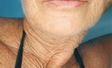 Radikalet e lira nuk janë fajtorë për plakjen