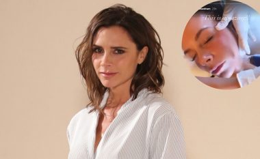 Victoria Beckham ndan video duke bërë ‘micro-needling’ me koktej vitaminash për të zvogëluar rrudhat dhe shenjat e akneve