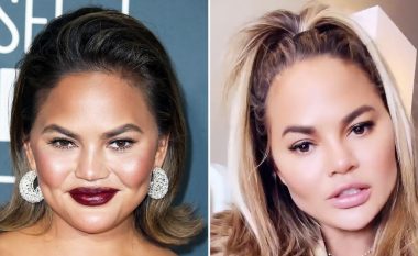 Chrissy Teigen tregon se ka hequr dhjamin nga faqet