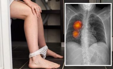 Shenja në urinën tuaj që paralajmëron se keni llojin më serioz të kancerit