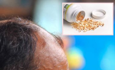 Mungesa e vitaminës D: Shenja paralajmëruese në kokën tuaj