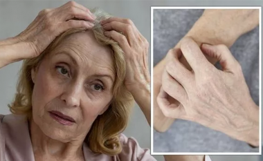 Menopauza: Pesë simptoma befasuese të lidhura me periudhën e tranzicionit