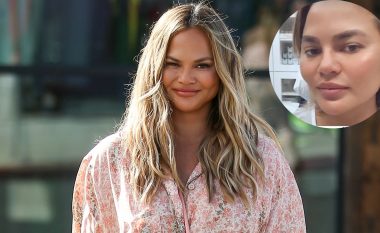 Chrissy Teigen tregon se ka transplantuar qimet e vetullave