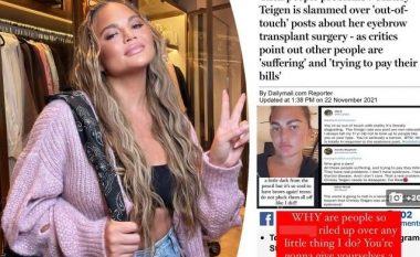 Chrissy Teigen i përgjigjet kritikëve të transplantit të vetullave