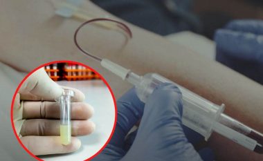 Simptomat e yndyrës së lartë në gjak: Kur trigliceridet kërcënojnë një atak në zemër
