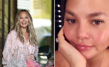 Chrissy Teigen tregon rezultatet pas transplantimit të vetullave