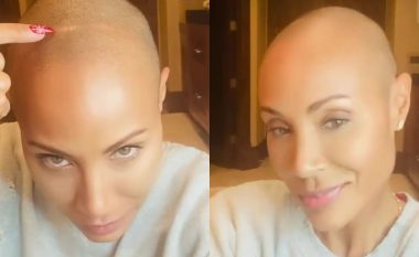 Jada Pinkett Smith ndan një përditësim për rënien e flokëve për shkak të alopecisë