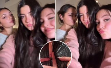 Yjet e TikTok-ut bëhen bashkë dhe realizojnë tatuazhe që përputhen