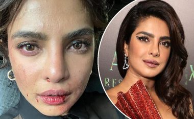 “A keni pasur edhe ju një ditë të vështirë në punë?” – Priyanka Chopra tregon grimin e mavijosur ndërsa filmon serialin “Citadel”