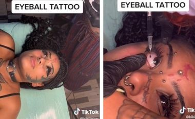 Braziliania bën tatuazh të bardhën e syve – publikon procesin në TikTok derisa i injektohet boja e zezë me shiringë