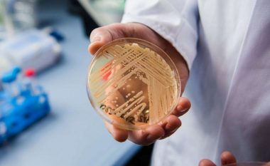 Infeksionet me Candida auris po përhapen shpejt në SHBA