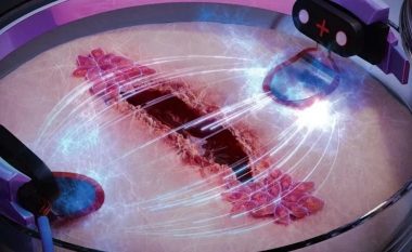 Një metodë e re e stimulimit elektrik mund të shërojë plagët deri në tre herë më shpejt