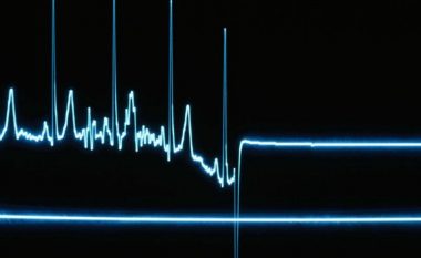 Katër gjëra që të gjithë i përjetojnë – mjekët tregojnë se çfarë ndodh saktësisht në çastet vdekjes