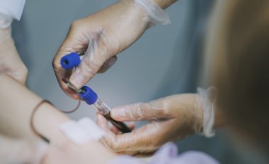 Gjaku i trashë, qarkullim i dobët – shkaktarët, simptomat dhe shërimi