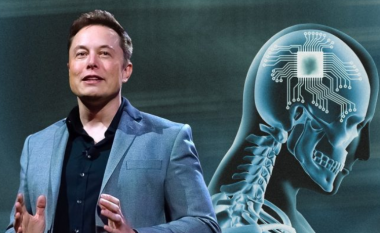 Elon Musk thotë se Neuralink ka implantuar çipin e parë të trurit te një njeri