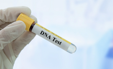 Postimi i saj shpejt u bë viral: Një 26-vjeçare zbulon se babai i saj nuk është ai biologjik pas një testi të ADN-së