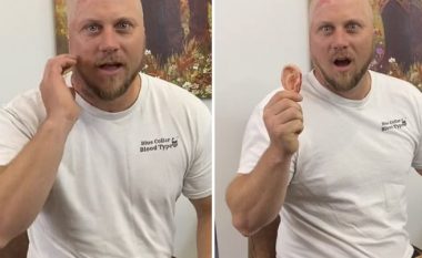 Humbi veshin pas një goditjeje prej 4100 voltësh: Tani është yll në rrjetet sociale, bën shaka në mënyra të çuditshme me incidentin