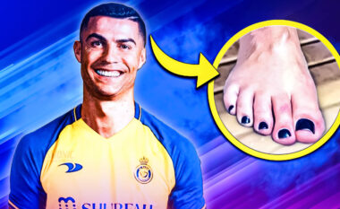 Pse Ronaldo ka gjithmonë manikyr të zi në këmbë? Ekziston një arsye e mirë