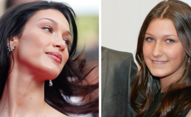 U shpall një nga femrat më të bukura në botë, por si dukej Bella Hadid para operacioneve plastike