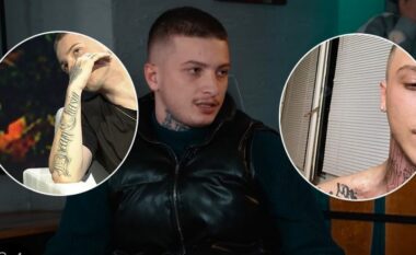 Fero publlikon fotografi nga seancat për shlyerjen e tatuazheve nga trupi, pas përpushtimit në fenë islame