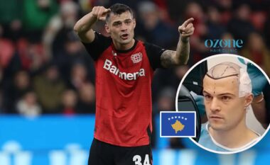 Xhaka tregon si e pritën bashkëlojtarët dhe trajneri Xabi Alonso transplantin e tij të flokëve në Kosovë – flet në detaje për ndjesitë e para