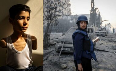 Portreti i djalit nga Gaza, i cili humbi të dy krahët në sulmin izraelit, është zgjedhur Fotoja e Vitit në World Press për vitin 2025