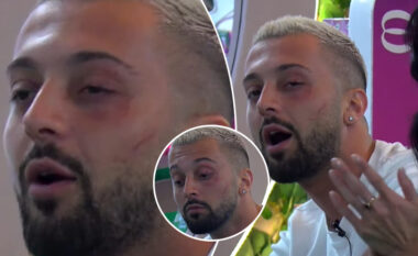 Gjendja e Gjestit një ditë pas sulmit fizik të Jozit në Big Brother VIP Albania 4, që ndodhi në transmetim direkt