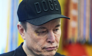 Musk shfaqet me sy të mavijosur: Djali më goditi me grusht
