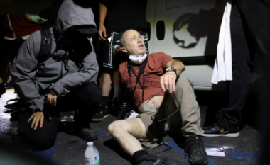 Fotografi britanik qëllohet me plumb gome në Los Angeles, tregon se si erdhi deri tek lëndimi