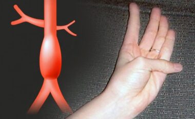 Një test i thjeshtë me gishtin e madh mund të zbulojë një rrezik të fshehur në aortë: Ja çfarë thotë mjeku