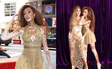 Winnie Harlow dukej elegante me fustan të artë teksa pozoi pranë “sozisë” së saj prej dylli