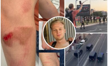 Studenti nga Beogradi rrëfen tmerrin që e përjetoi kur u arrestua nga policia serbe gjatë protestës  