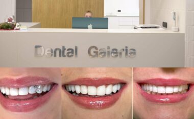 Dental Galeria: Investimi veror për një buzëqeshje të shëndetshme