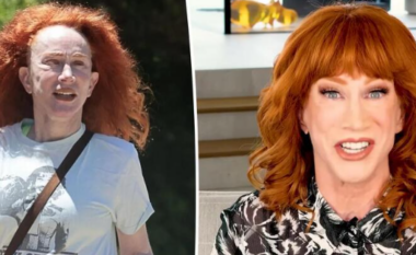 Aktorja Kathy Griffin e panjohur pas operacionit të tretë të fytyrës