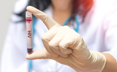 Kosova me 19 raste të reja me HIV/AIDS brenda shtatë muajve, shënohet edhe një viktimë